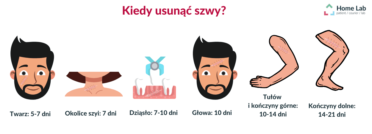 Czas usunięcia szwów.png