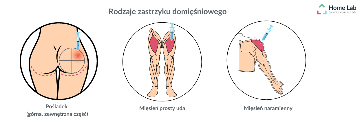 Rodzaje zastrzyku domięśniowego.png