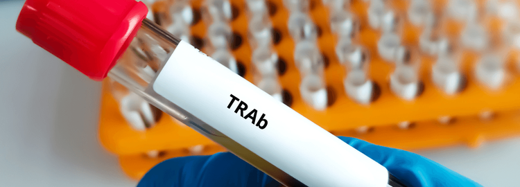 Przeciwciała przeciwko receptorowi TSH (TRAb)- normy, badania i ...
